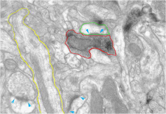 Example of a TEM image of neuronal tissue